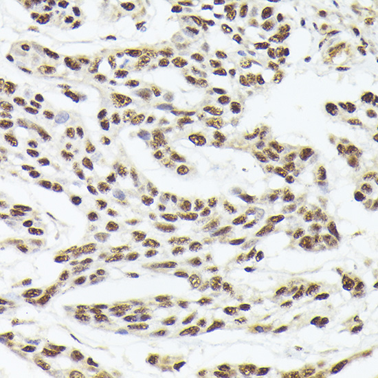 Nuclear Matrix Protein p84 (THOC1) Rabbit polyclonal antibody