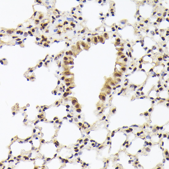 Nuclear Matrix Protein p84 (THOC1) Rabbit polyclonal antibody