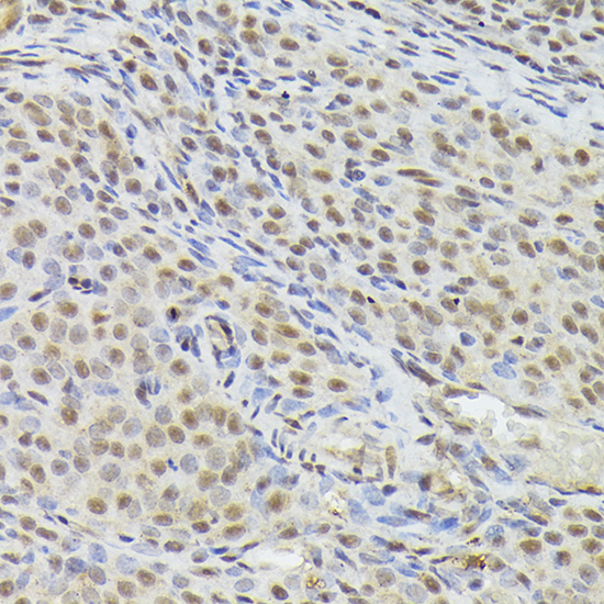 Nuclear Matrix Protein p84 (THOC1) Rabbit polyclonal antibody