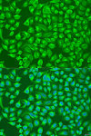 Immunofluorescence - SLC12A6 Rabbit pAb (A8180)