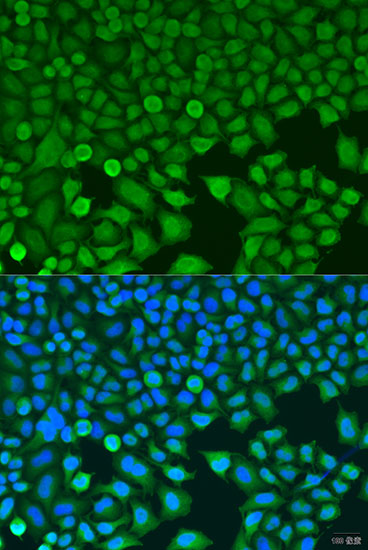 BCKDK Rabbit polyclonal antibody