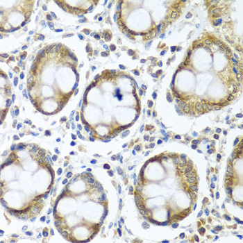 IFI44 Rabbit polyclonal antibody