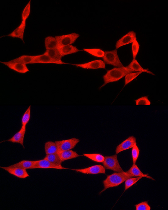IFI44 Rabbit polyclonal antibody