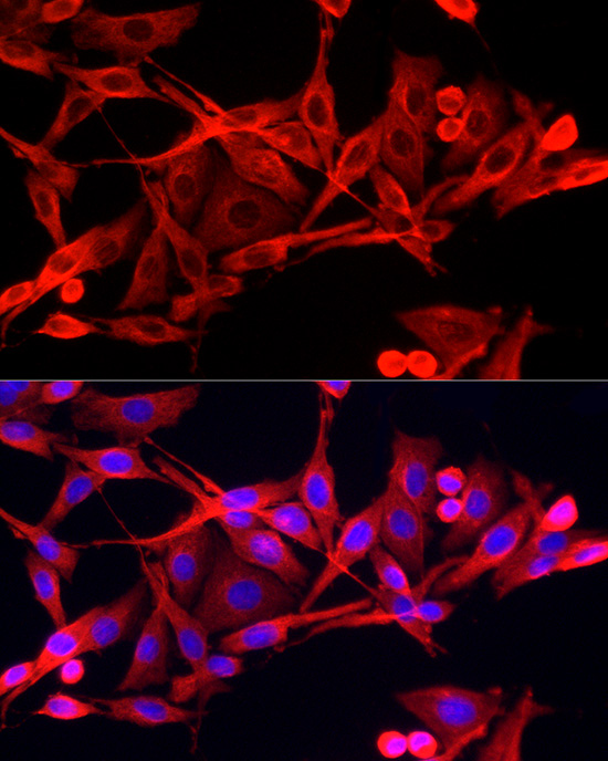 IFI44 Rabbit polyclonal antibody