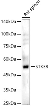 STK38 Rabbit polyclonal antibody