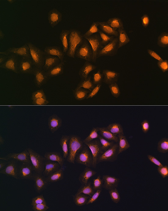 STK38 Rabbit polyclonal antibody