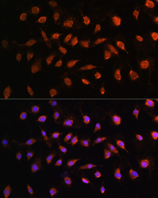 STK38 Rabbit polyclonal antibody