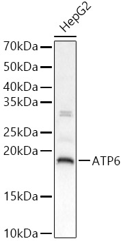 ATP6 Rabbit polyclonal antibody
