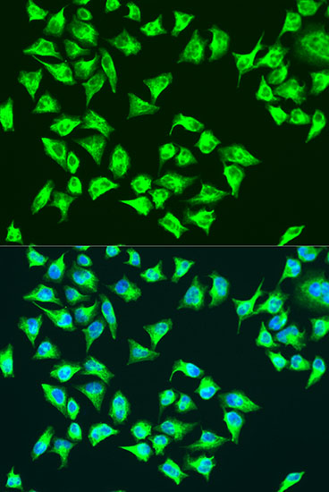 ATP6 Rabbit polyclonal antibody