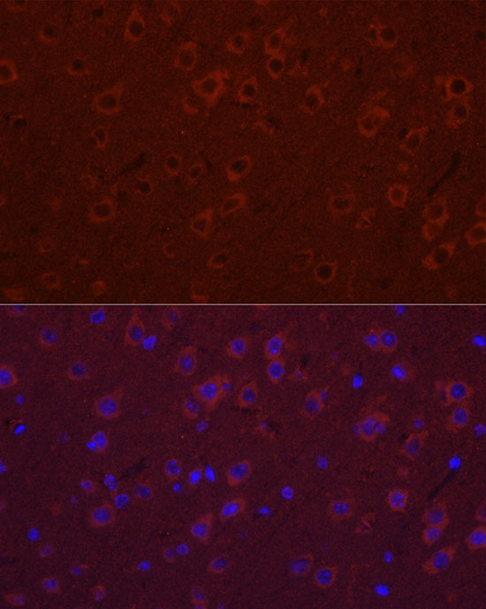 SYT11 Rabbit polyclonal antibody