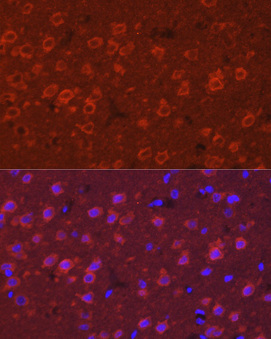 SYT11 Rabbit polyclonal antibody