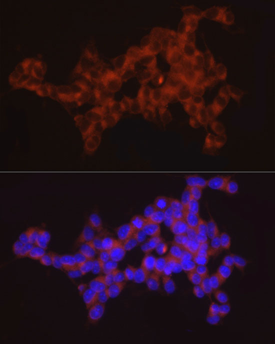 SYT11 Rabbit polyclonal antibody