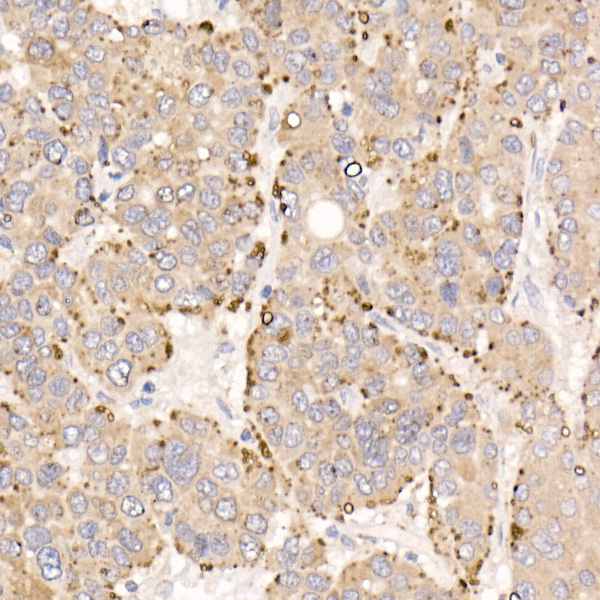 METTL7A Rabbit polyclonal antibody