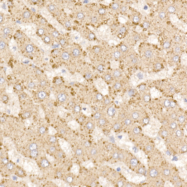 METTL7A Rabbit polyclonal antibody