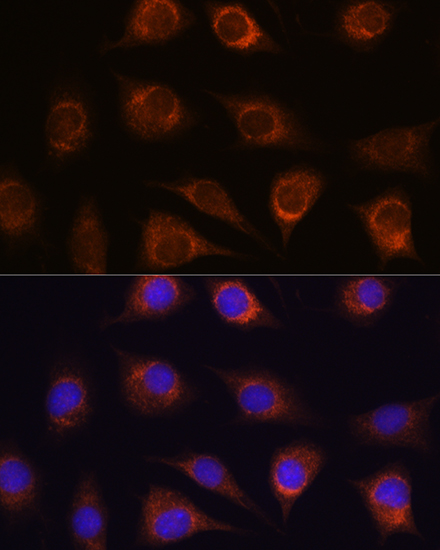 METTL7A Rabbit polyclonal antibody