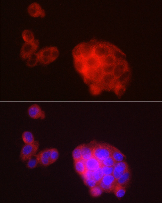 METTL7A Rabbit polyclonal antibody