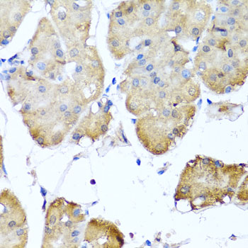 NIN Rabbit polyclonal antibody
