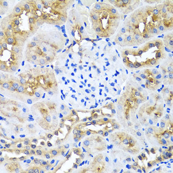 NIN Rabbit polyclonal antibody