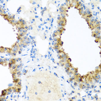 NIN Rabbit polyclonal antibody