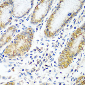 ATAD3A Rabbit polyclonal antibody