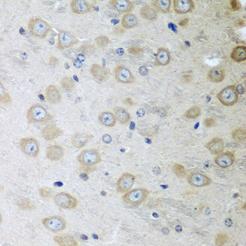 ATAD3A Rabbit polyclonal antibody