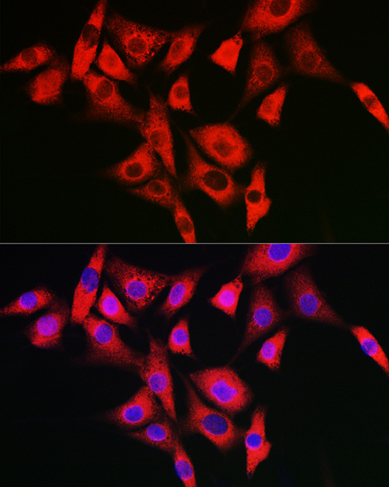 NLRP2 Rabbit polyclonal antibody