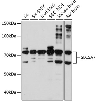SLC5A7 Rabbit polyclonal antibody