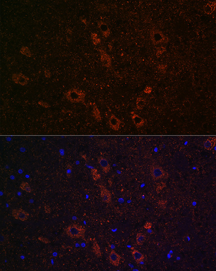 SLC5A7 Rabbit polyclonal antibody