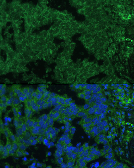 IL25 Rabbit polyclonal antibody