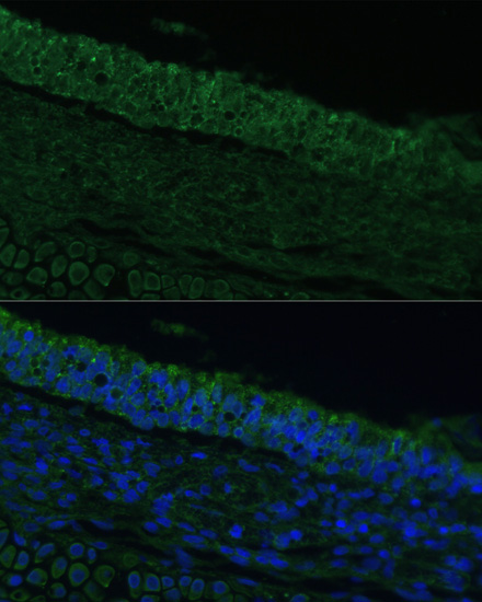 IL25 Rabbit polyclonal antibody
