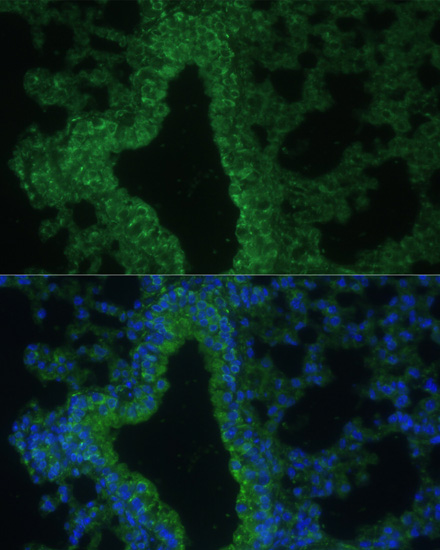 IL25 Rabbit polyclonal antibody