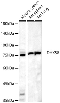 DHX58 Rabbit polyclonal antibody