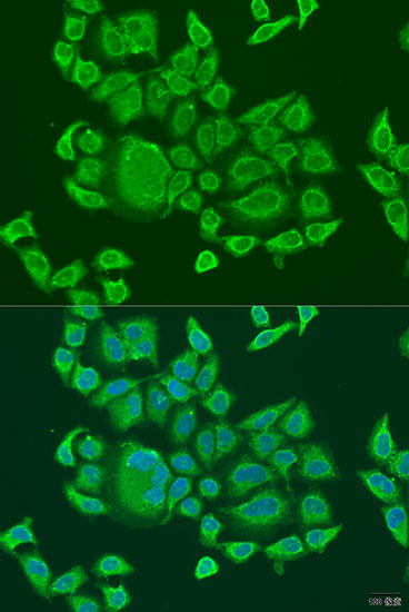 DHX58 Rabbit polyclonal antibody