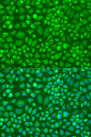 DNAL1 Rabbit polyclonal antibody