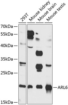 ARL6 Rabbit polyclonal antibody
