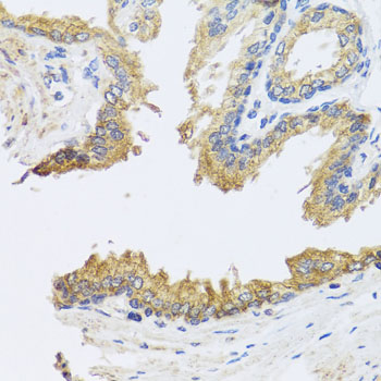 ARL6 Rabbit polyclonal antibody