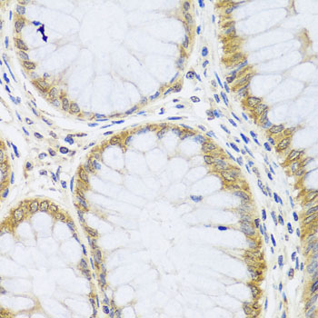 ARL6 Rabbit polyclonal antibody