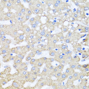ARL6 Rabbit polyclonal antibody