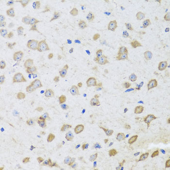 ARL6 Rabbit polyclonal antibody