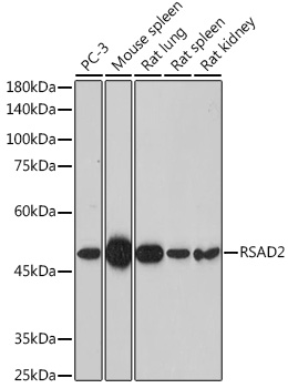 RSAD2 Rabbit polyclonal antibody