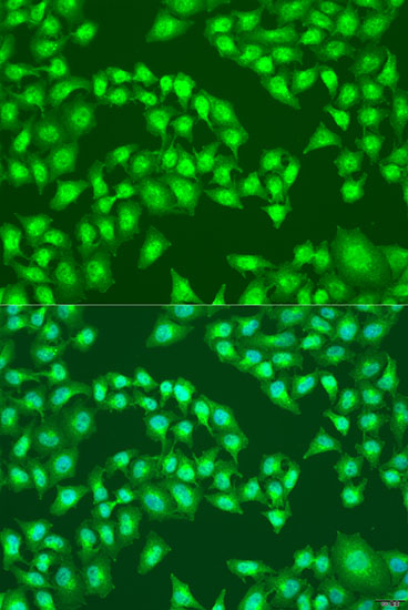 RSAD2 Rabbit polyclonal antibody