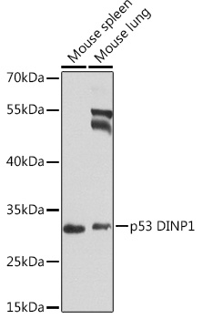 p53 DINP1 Rabbit pAb