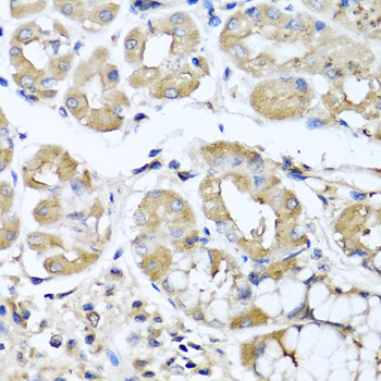 IFNL1 Rabbit polyclonal antibody
