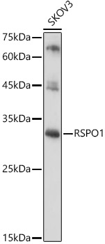 RSPO1 Rabbit polyclonal antibody