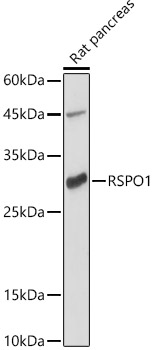 RSPO1 Rabbit polyclonal antibody