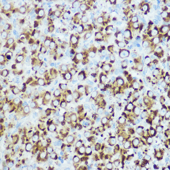 RSPO1 Rabbit polyclonal antibody