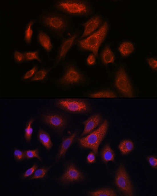 RSPO1 Rabbit polyclonal antibody