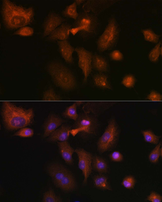 RSPO1 Rabbit polyclonal antibody