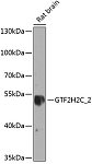 Western blot - GTF2H2C_2 Rabbit pAb (A8297)