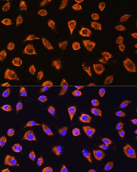 NOTCH4 Rabbit polyclonal antibody